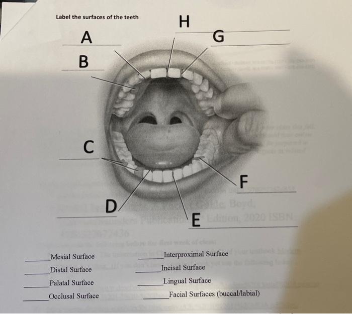 buccal tooth surface