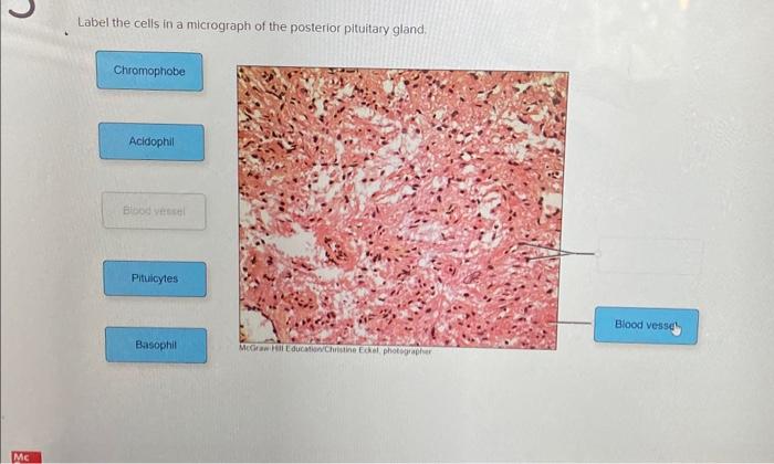 Solved Label the cells in a micrograph of the posterior | Chegg.com