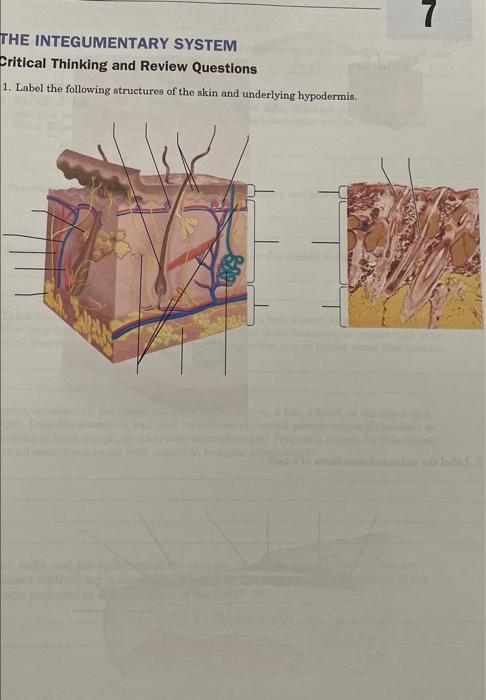 integumentary system critical thinking questions