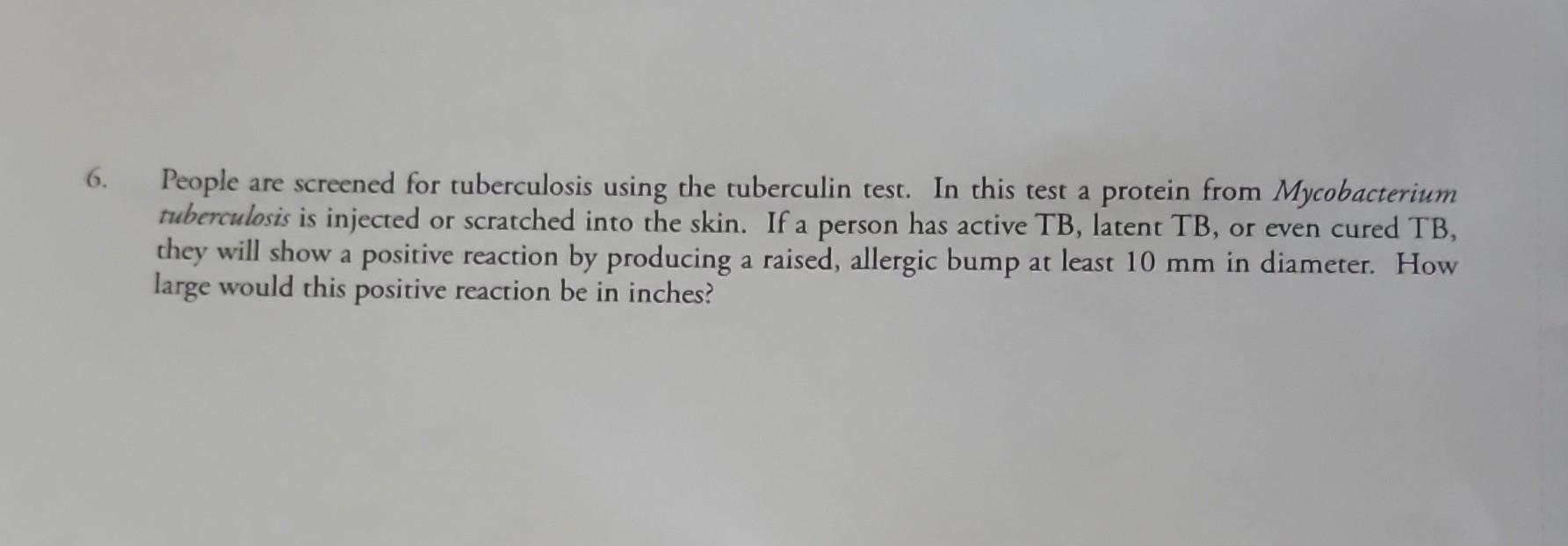 Solved People Are Screened For Tuberculosis Using The Chegg Com   Image 