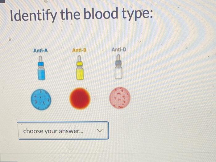 Identify the blood type: