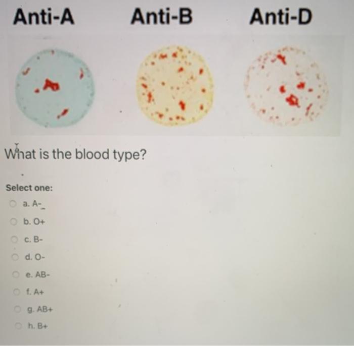 Solved Anti-A Anti-B Anti-D What Is The Blood Type? Select | Chegg.com