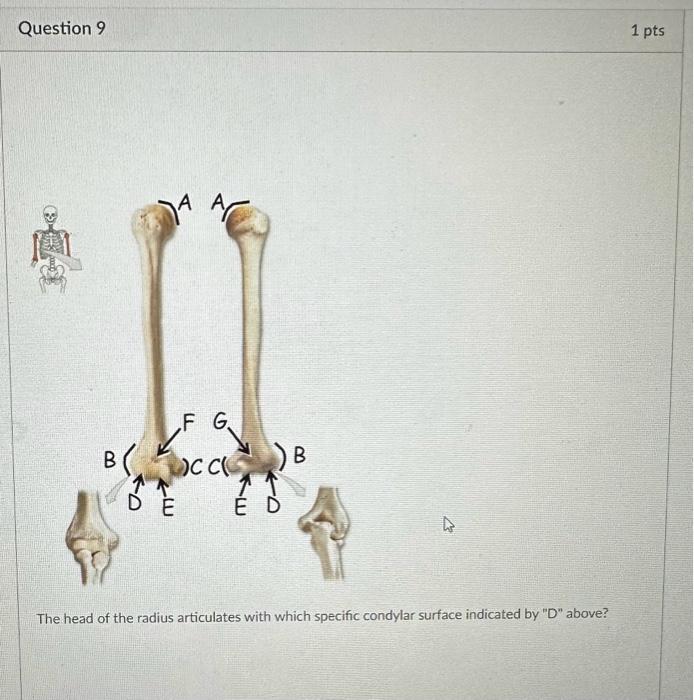 Solved The head of the radius articulates with which