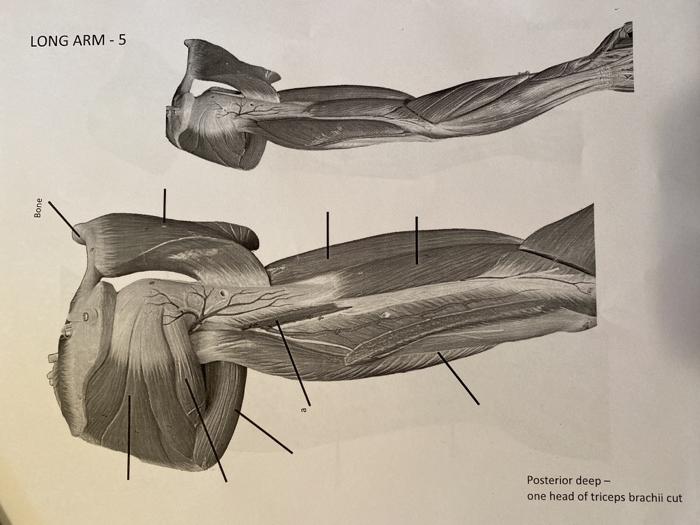 LONG ARM - 5 Bone Posterior deep- one head of triceps brachii cut