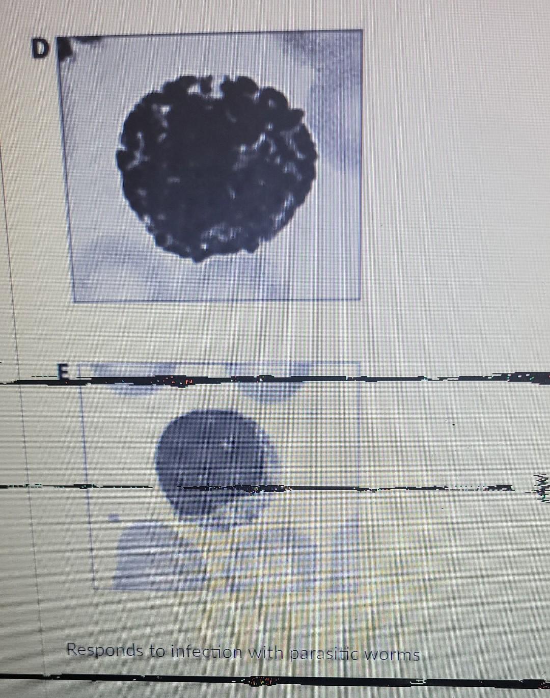 Responds To Infection With Parasitic Worms Responds Chegg Responds To Infection With Parasitic Worms Responds Chegg