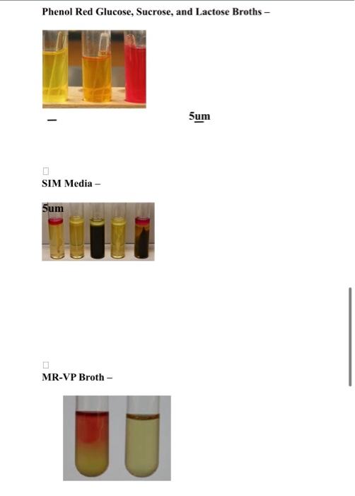 Laboratory Exercise 13 Bacterial Isolation and