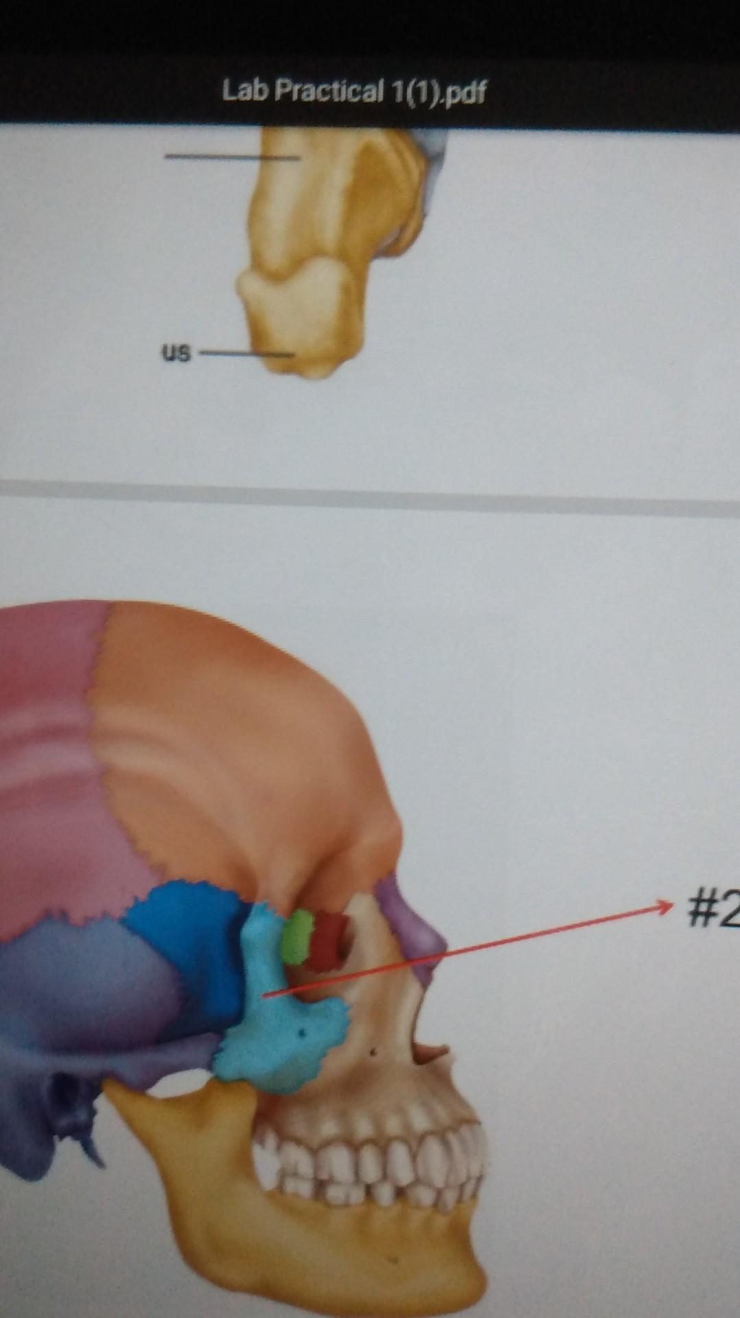 Solved Lab Practical 1(1).pdf #22 *Name the 