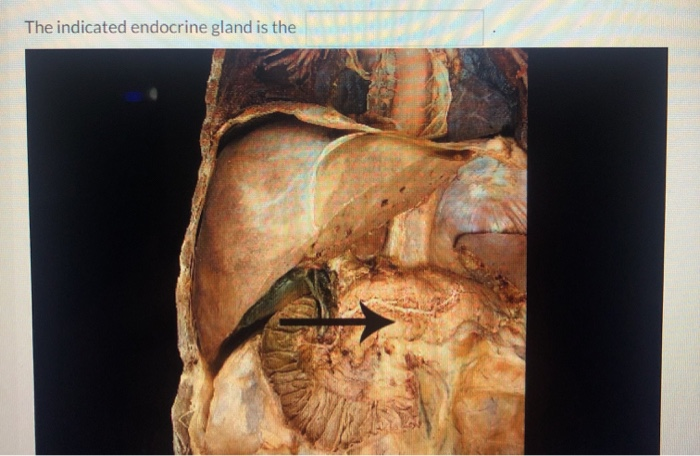 Solved The Indicated Endocrine Gland Is The | Chegg.com