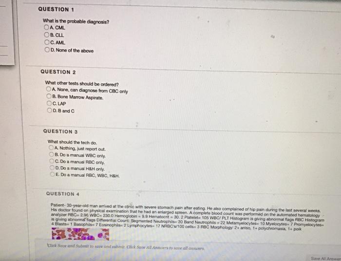 QUESTION 1 What is the probable diagnosis? OA CML OB.CLL C. AML OD. None of the above QUESTION 2 What other tests should be o