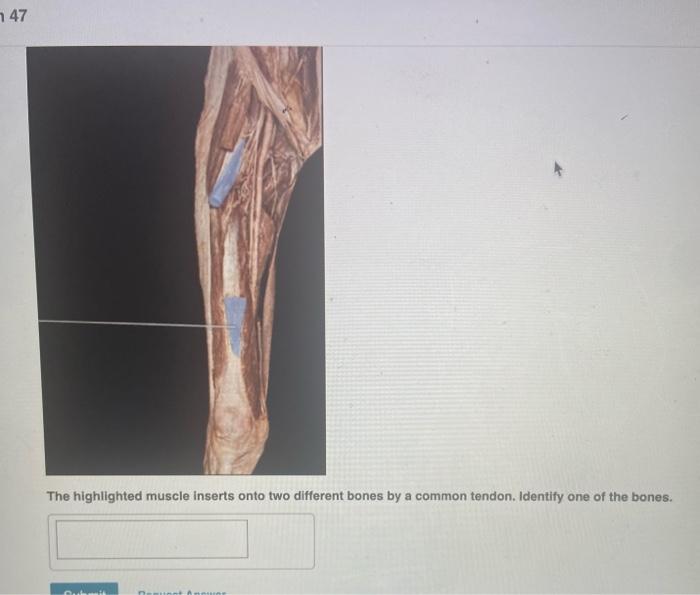 Solved 747 The highlighted muscle inserts onto two different | Chegg.com