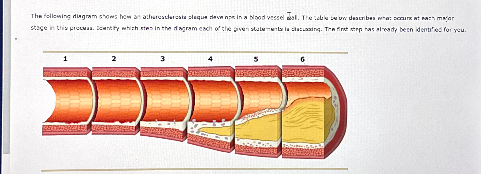 Solved The following diagram shows how an atherosclerosis | Chegg.com