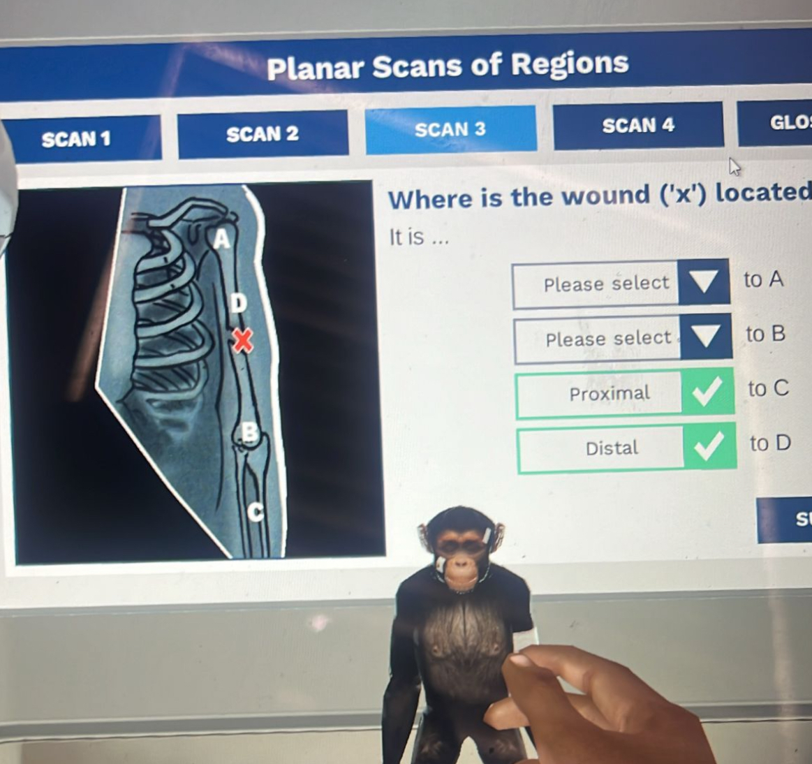 Solved Planar Scans of RegionsSCAN 1Where is the wound | Chegg.com