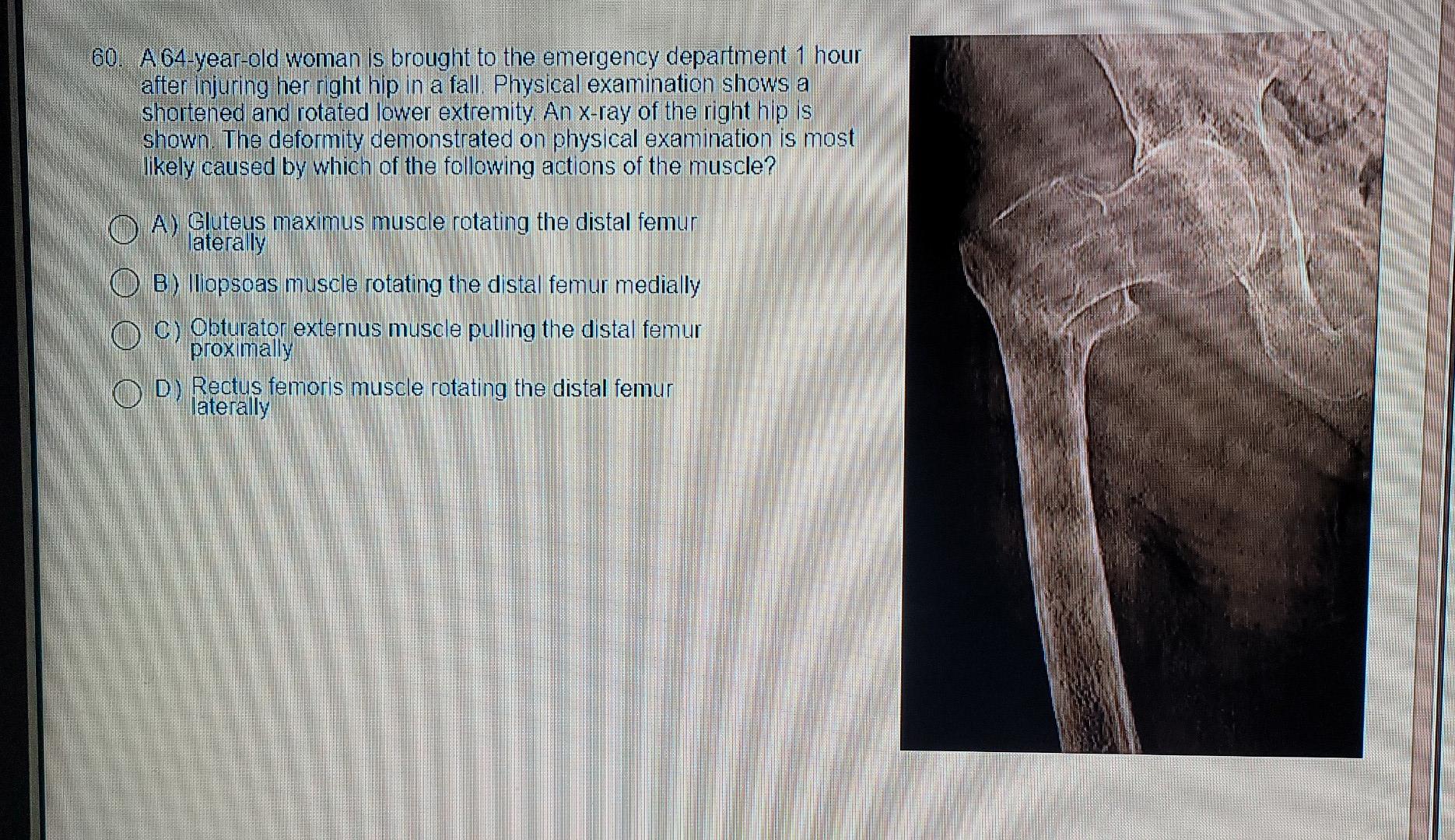 Solved 60. A 64-year-old woman is brought to the emergency | Chegg.com
