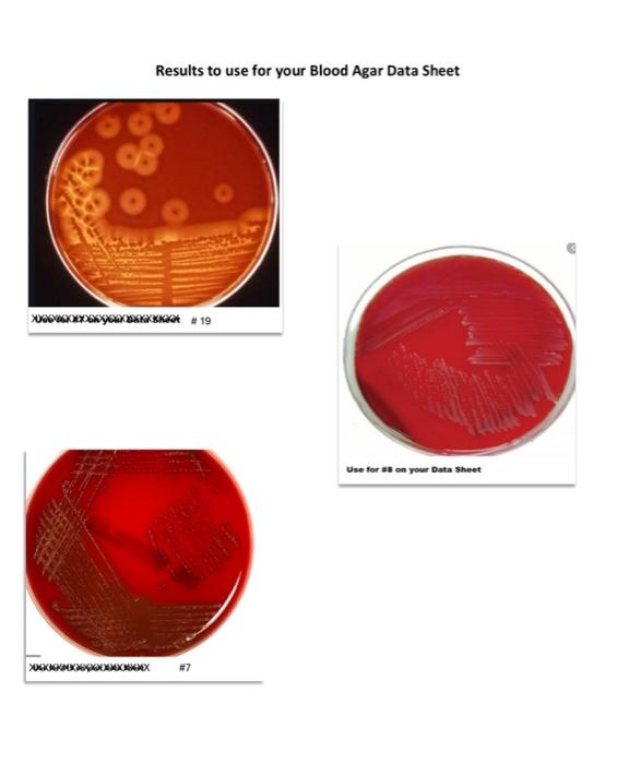 Secon presented porto DATA SHEET 5-21 Blood Agar | Chegg.com