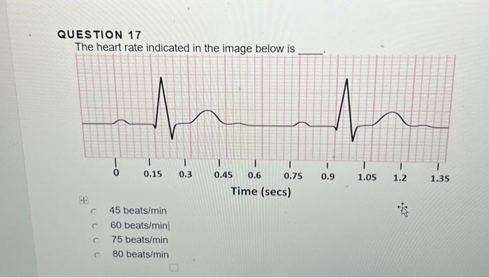 Solved In the image below, the endothelium is indicated by | Chegg.com