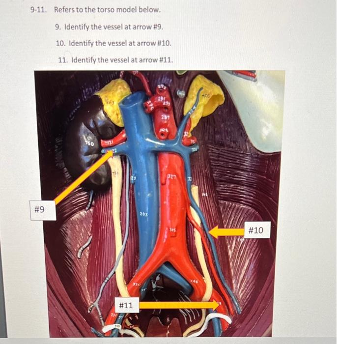 9-11. Refers to the torso model below.
9. Identify the vessel at arrow \( \# 9 \).
10. Identify the vessel at arrow # \( \# 1