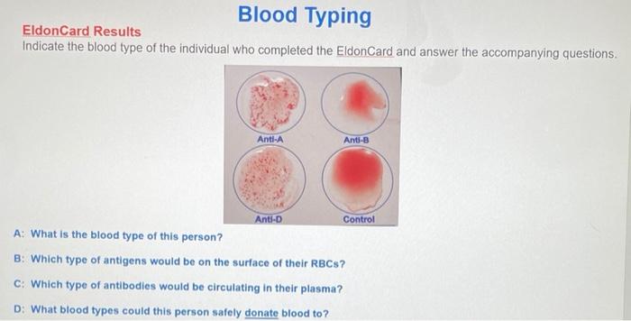 TIL that, O positive blood is the most common blood type. : r/todayilearned