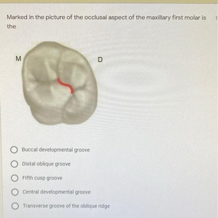 Solved Marked in the picture of the occlusal aspect of the