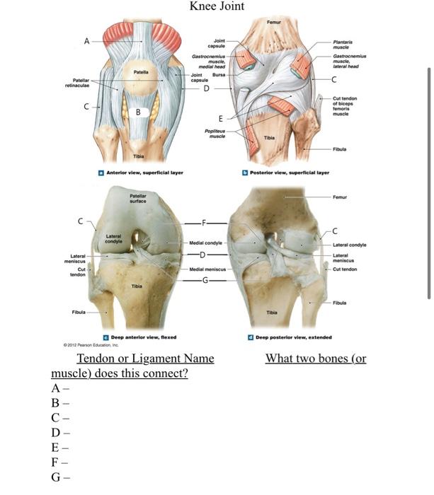 Patellar
retinaculae
?
FC
|||
Medial condyle
Lateral
meniscus
Cut
Medial meniscus
tendon
Tibia
Fibula
Deep anterior view, fle