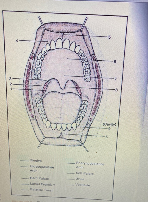 Solved 5 PESME 09 3 2 1 8 SANDE (Cavity) 9 5 Gingiva