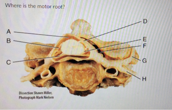 Solved Where is the trigeminal nerve? с A B D H- E -F G - K | Chegg.com