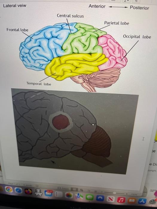 8[Choose] [Choose] [Choose]Lateral veiw Anterior | Chegg.com