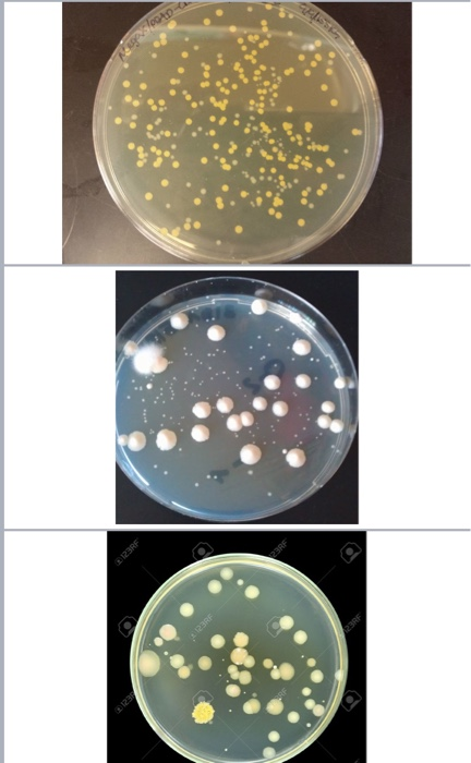 Staphylococcus Aureus Stock Photos and Images - 123RF