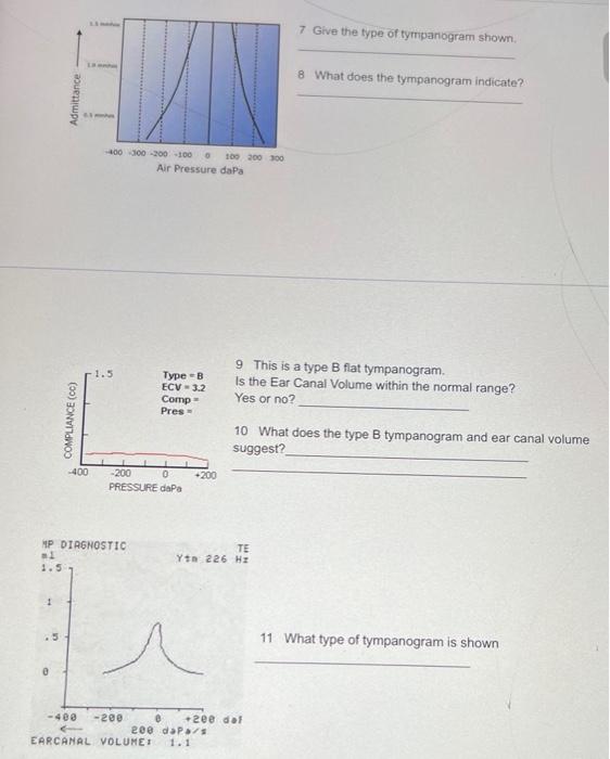 Solved 7 Give the type of tympanogram shown. 8 What does the