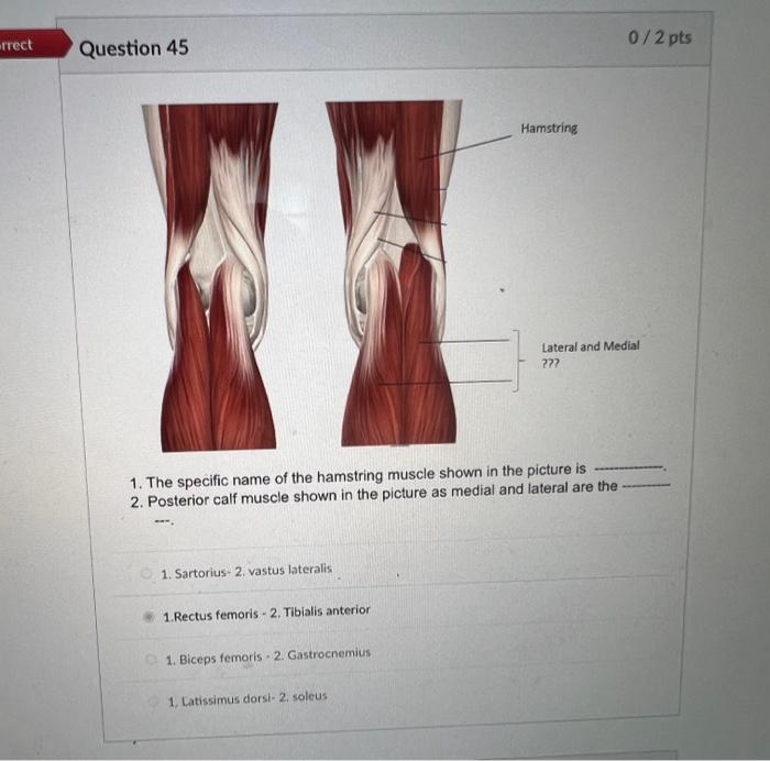 Solved rrect Question 45 1. Sartorius- 2. vastus lateralis | Chegg.com