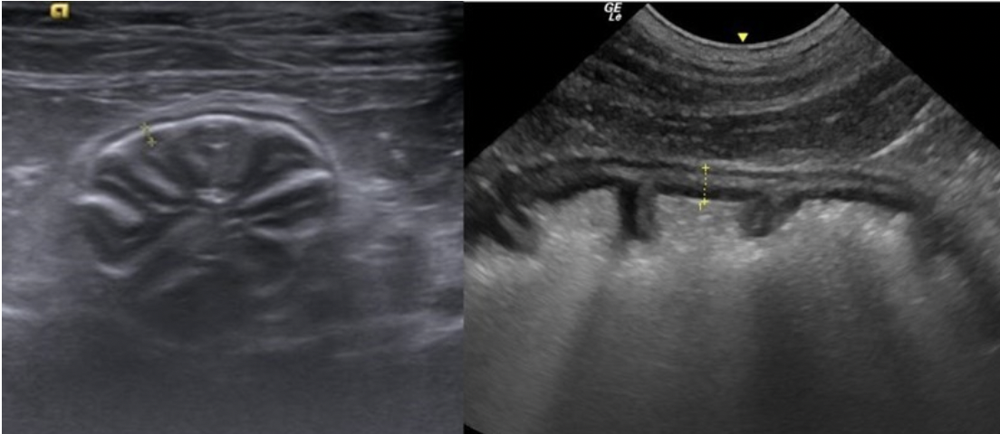 Solved what anatomy is being imaged on this ultrasound Biology Diagrams