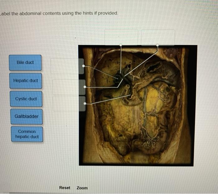 Solved Label the abdominal contents using the hints if