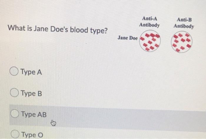 Solved What type of antibodies against red blood cell | Chegg.com