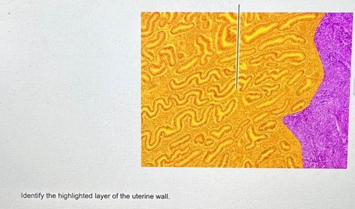 Identify the highlighted layer of the uterine wall.