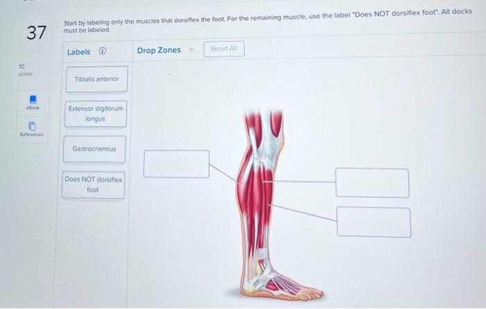 Solved Start by labeling only the muscles that dorsiflex the | Chegg.com