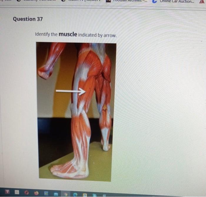 Solved Question 35 Where is the insertion of the muscle