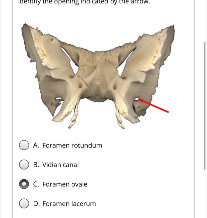foramen rotundum and ovale