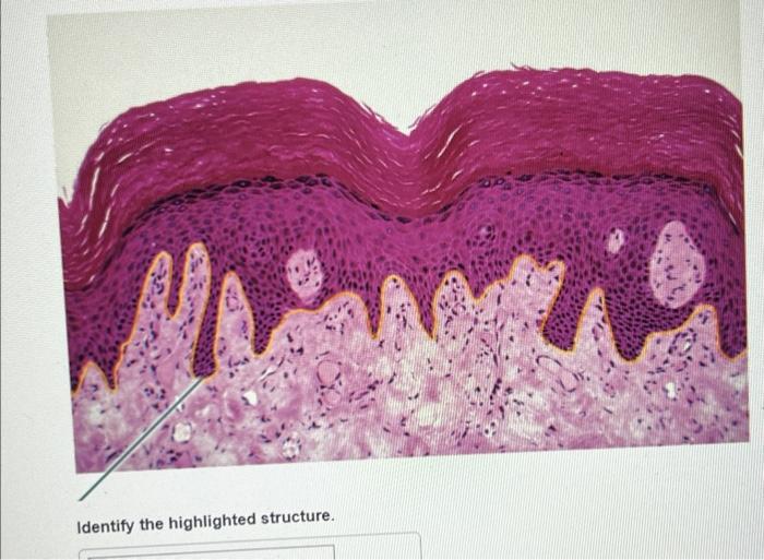 Solved Identify the highlighted structure. | Chegg.com