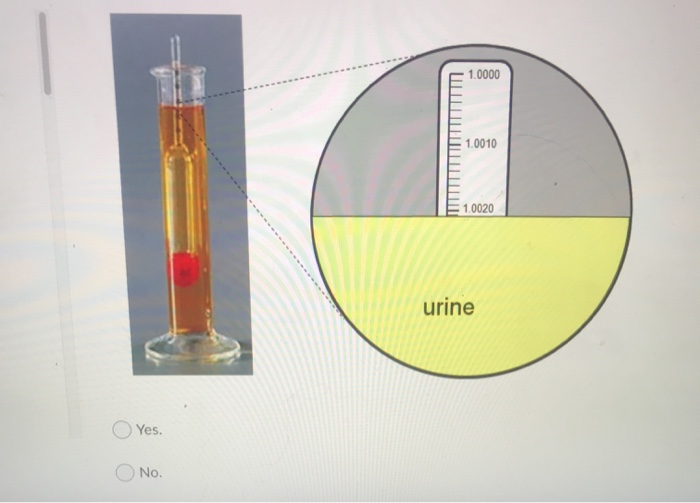 Solved 16. Is the specific gravity (SG) of this urine sample | Chegg.com