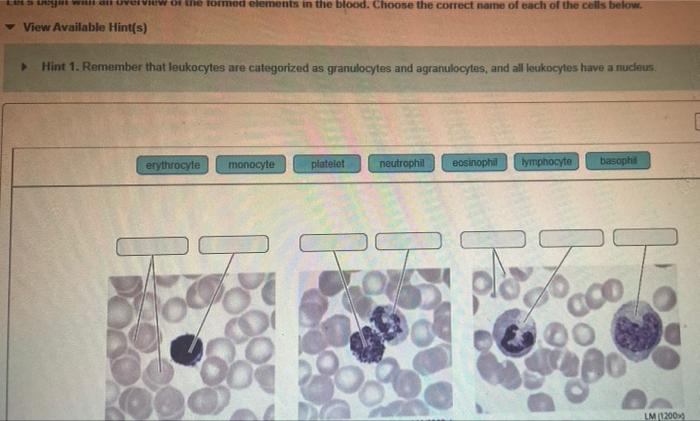 Solved Clinical Scenario Blood Formed Elements And Chegg