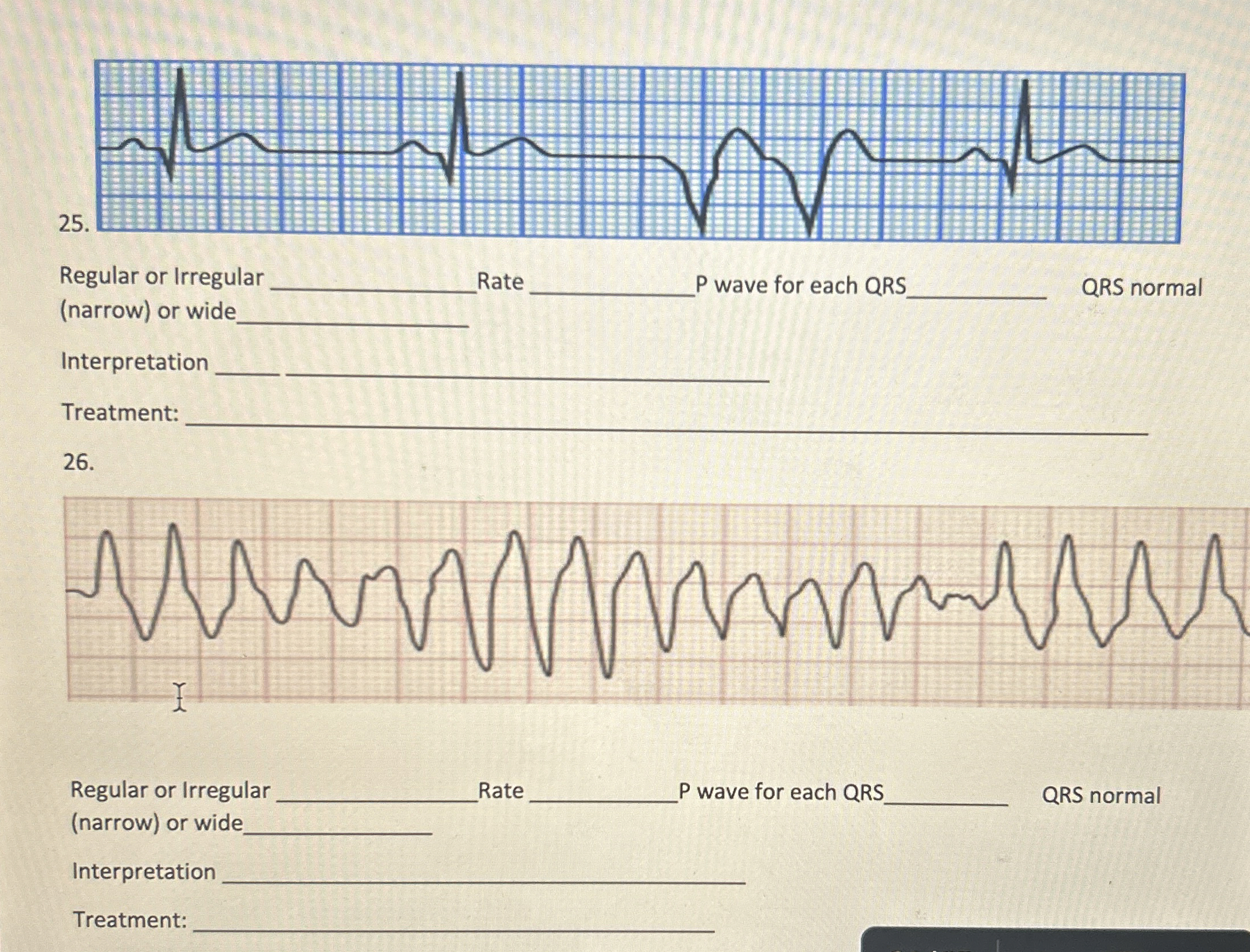 Solved 25Regular or IrregularRate(narrow) ﻿or wideP wave for | Chegg.com