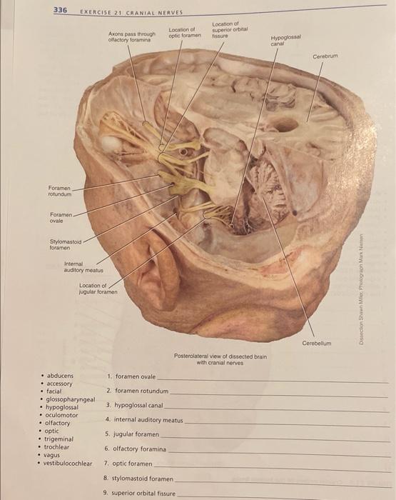 Solved 191 EXERCISE 27, BRAIN AND CRANIAL NERVES QUIZ 1.