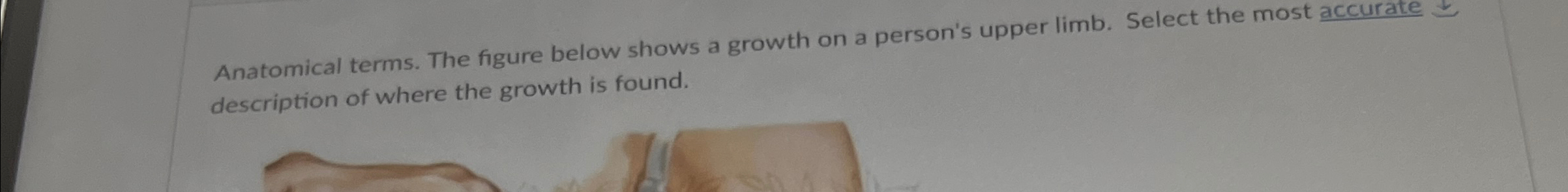 Solved Anatomical terms. The figure below shows a growth on | Chegg.com