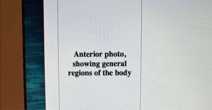 Anterior photo, showing general regions of the body