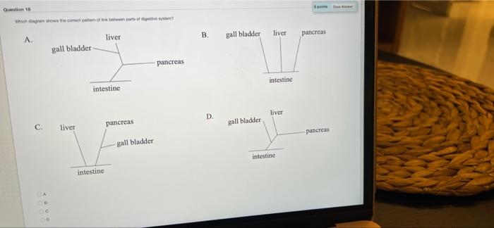 Solved Question In B. Liver Gall Bladder Pancreas A Liver | Chegg.com