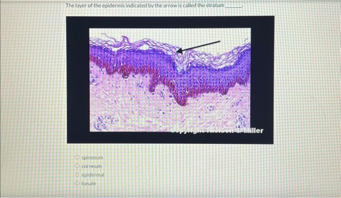 The layer of the epidermis indicated by the arrow is called the stratum
spinosum
corneum
epidermal