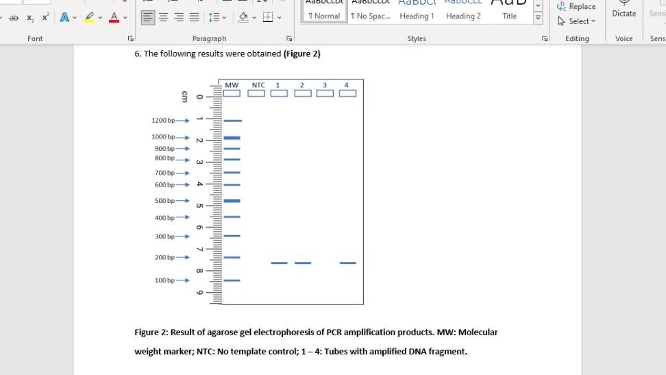 Solved Figure 2 Result of agarose gel electrophoresis of