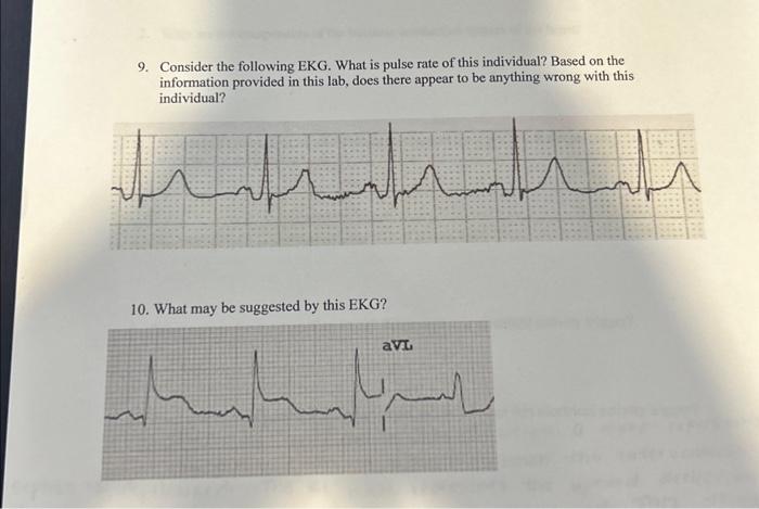 Solved 9. Consider The Following EKG. What Is Pulse Rate Of | Chegg.com