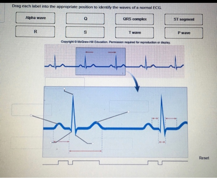 Solved Drag each label into the appropriate position to | Chegg.com