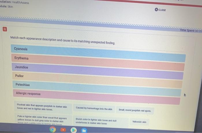 ulation HealthAssess dule: Skin CLOSE Time Spent: 00:35 Match each appearance description and cause to its matching unexpecte