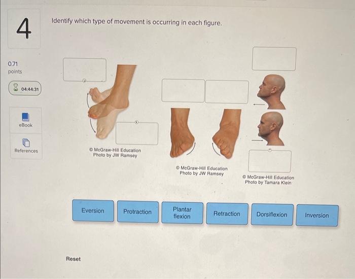 Solved Identify Which Type Of Movement Is Occurring In Each